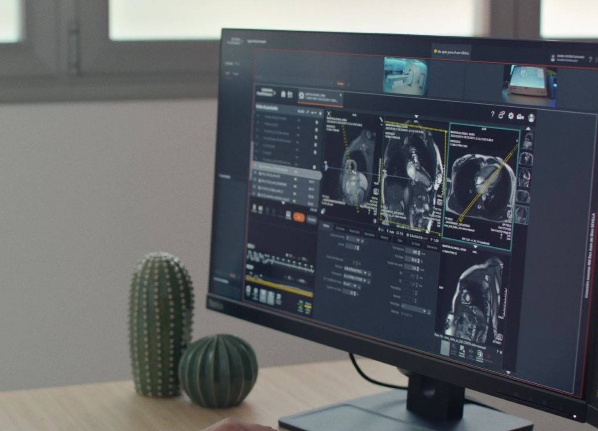 HT Médica añade un software de Siemens que reduce listas de espera en radiología