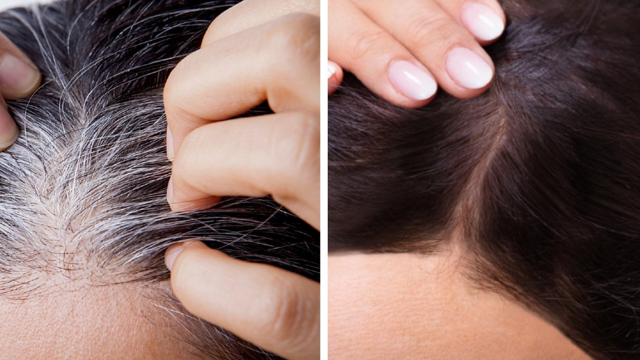 Despídete de las canas con estos alimentos, naturales y sanos