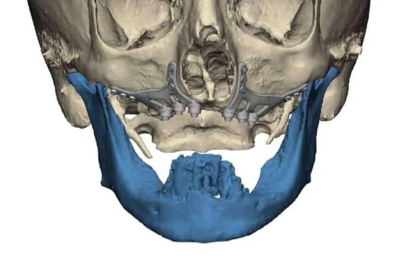 La Clínica Calvo de Mora es una clínica maxilofacial experta en cirugías ortognáticas