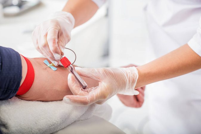 Desvelando secretos: la revolucionaria detección del Parkinson a través de un análisis de sangre
