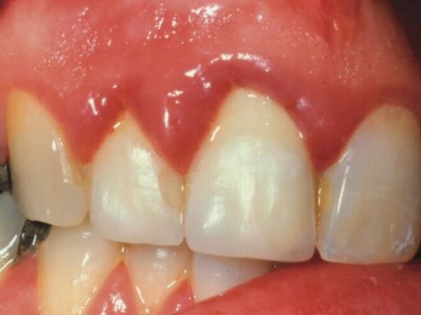 dientes 1 Merca2.es