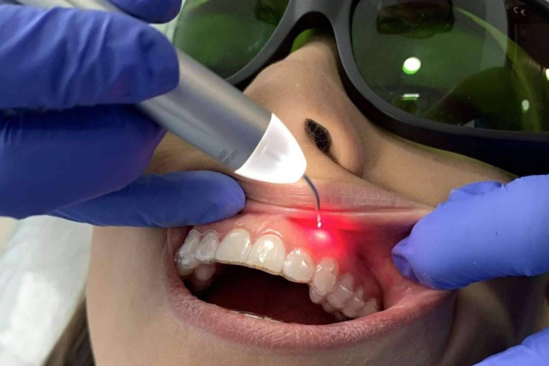 Estética dental con las últimas tecnologías, por Dental Implantologie