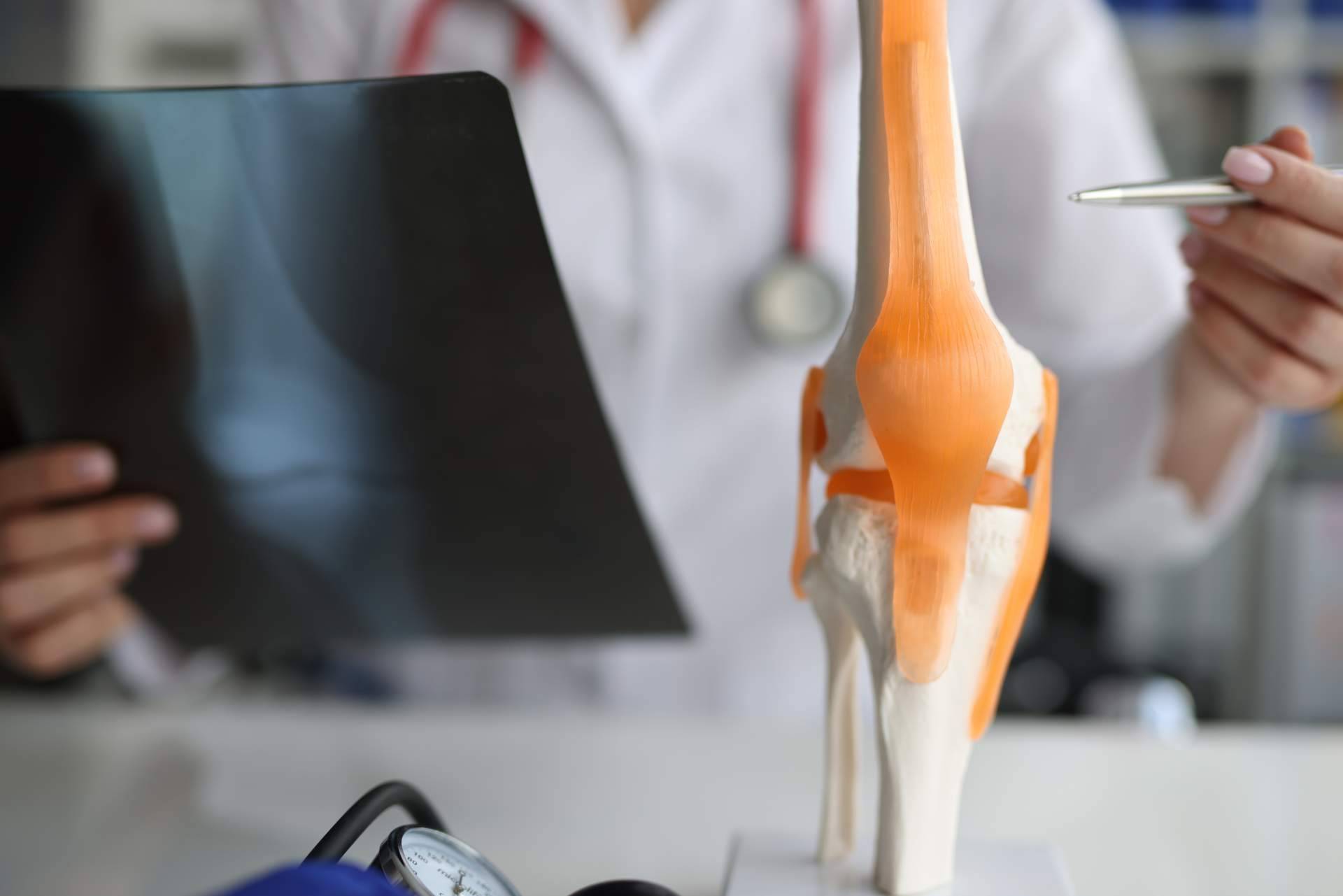 ¿Qué es la tenodesis?, por el Dr. Miguel Romero