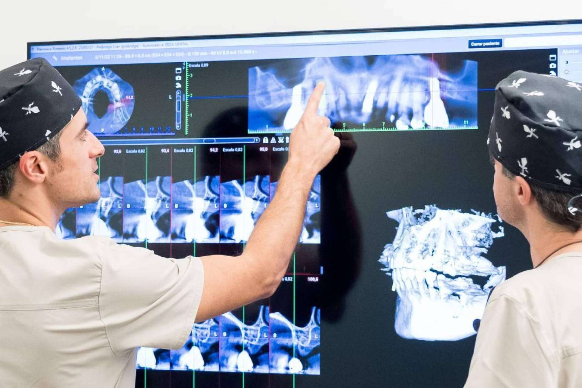 La innovadora técnica de injerto de encías restaura la salud y estética dental con precisión