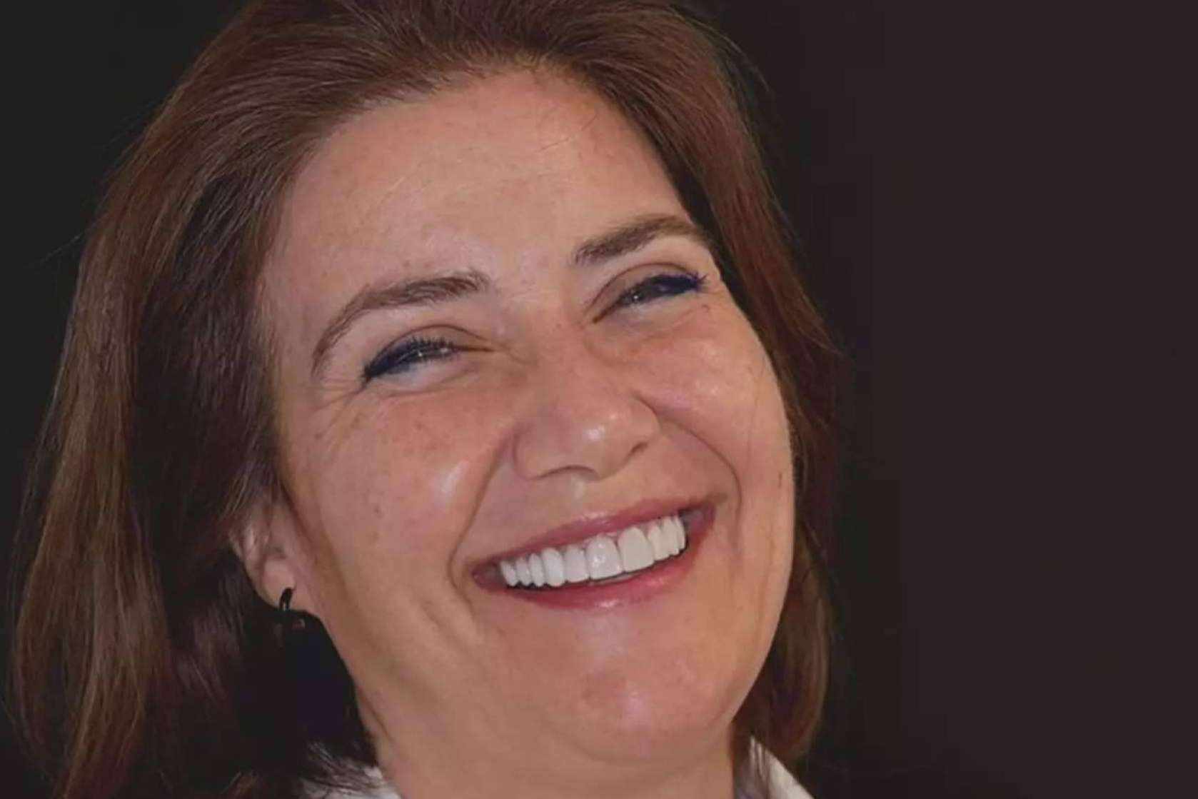 Denty Dent mejora la sonrisa de sus pacientes con tratamientos de estética dental