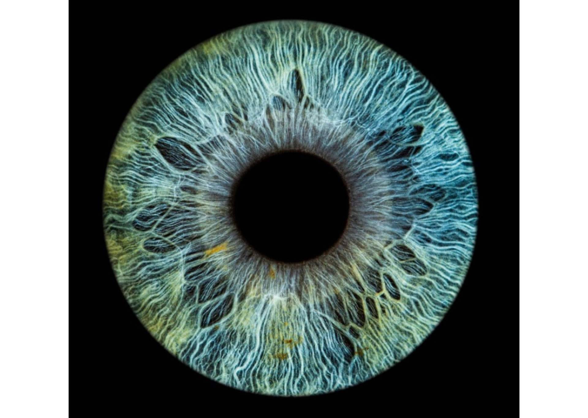 La clínica Eyecos desarrolla un software con tecnología puntera para evaluar el color de los ojos