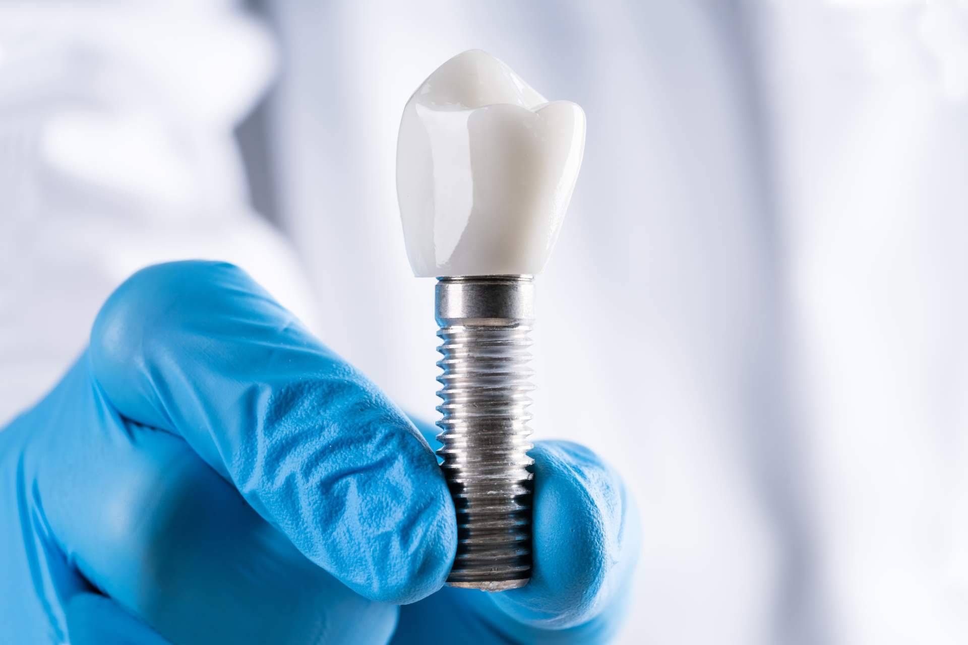Clínica Dental Arai y sus servicios profesionales de implantología dental en Barcelona