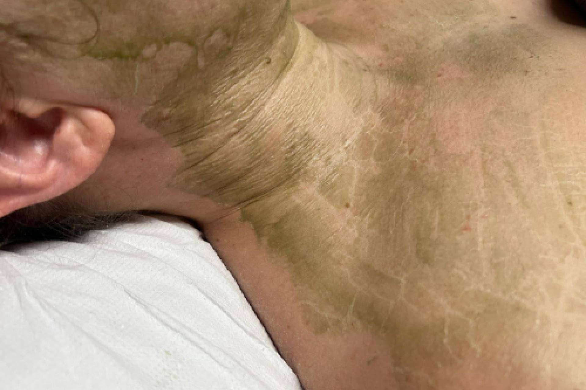 La revolución en los centros de estética, mascarilla enzimática cosmedique
