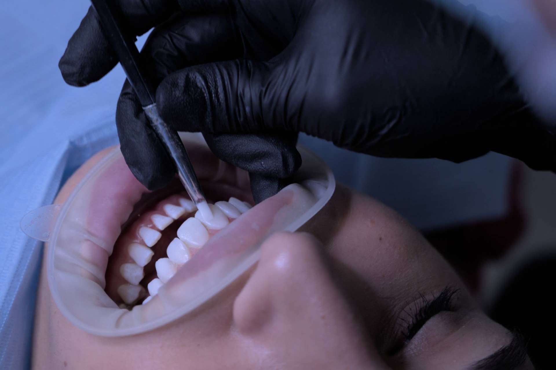 Denty Dent, expertos en tratamientos de estética dental