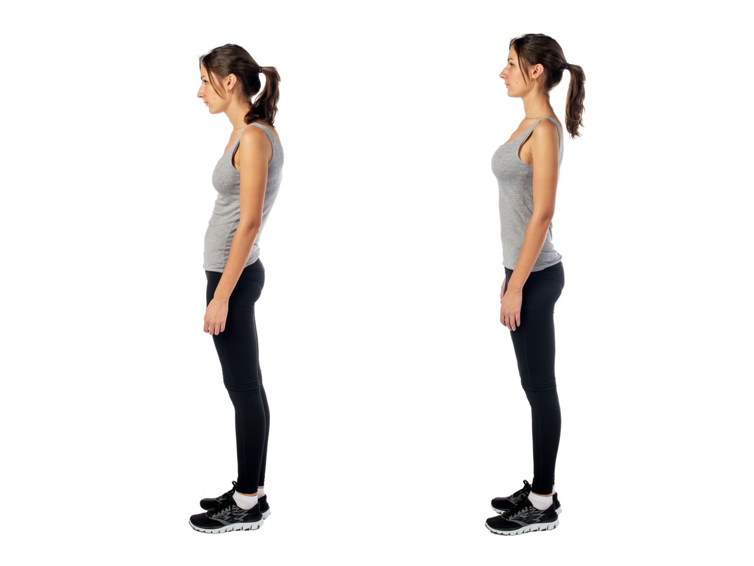 LA IMPORTANCIA DE LA POSTURA Y LA ABDOMINOPLASTIA COMO ÚLTIMA OPCIÓN