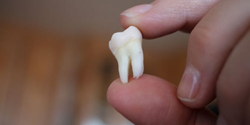 ¿Por qué denominamos a las muelas del juicio de esta manera y cuál es su función? 83 Merca2.es Algo que ya no necesitas, pero que tu cuerpo produce de todas formas