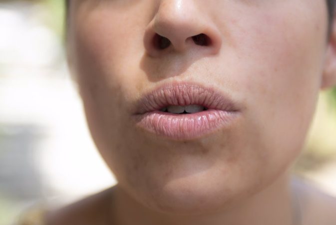 Cómo evitar el problemático acto de respirar por la boca