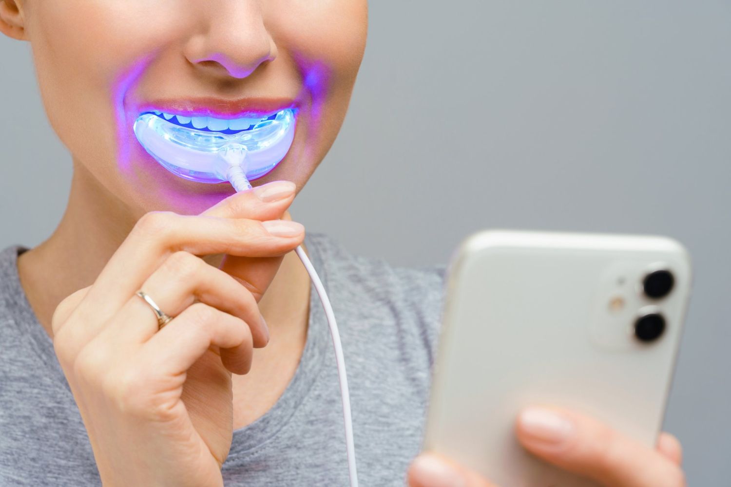 Si estás pensando en blanquearte los dientes, no lo hagas por tu cuenta o te puedes arrepentir