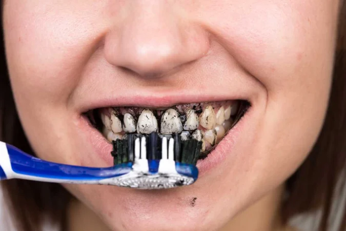 dientes