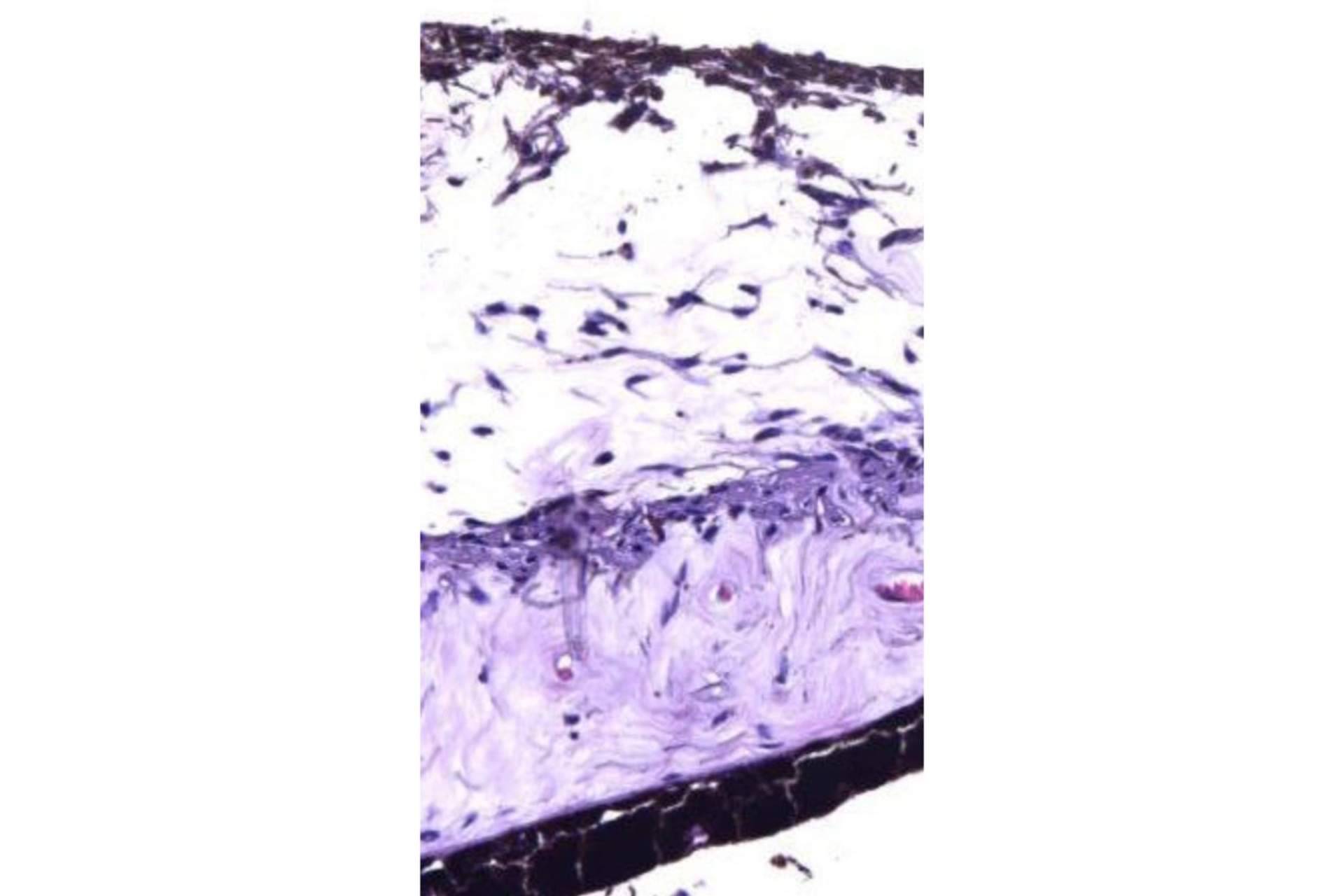 La clínica Eyecos explica cómo la histología del iris influye en el color de los ojos