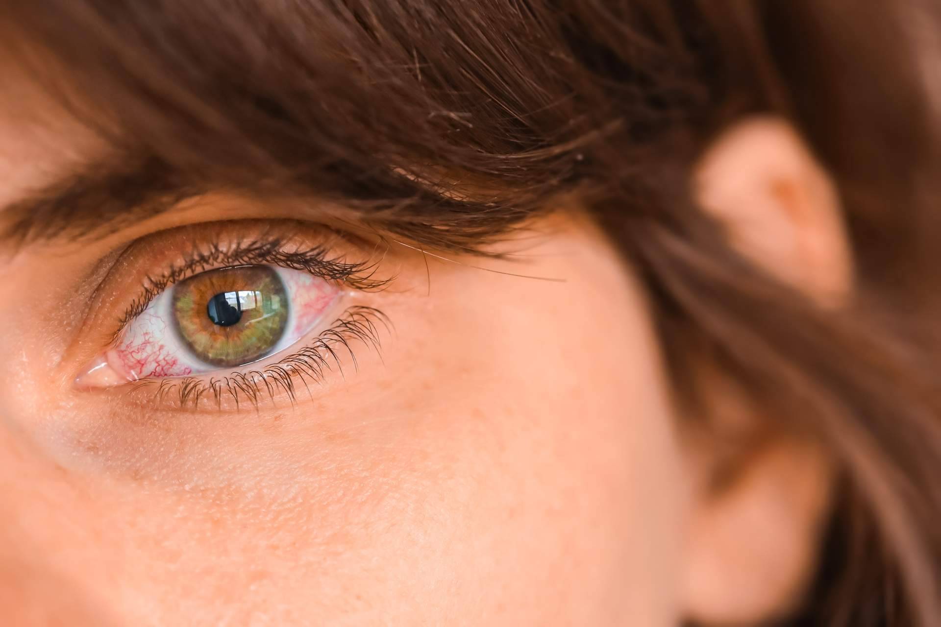 La solución ideal para combatir el ojo seco