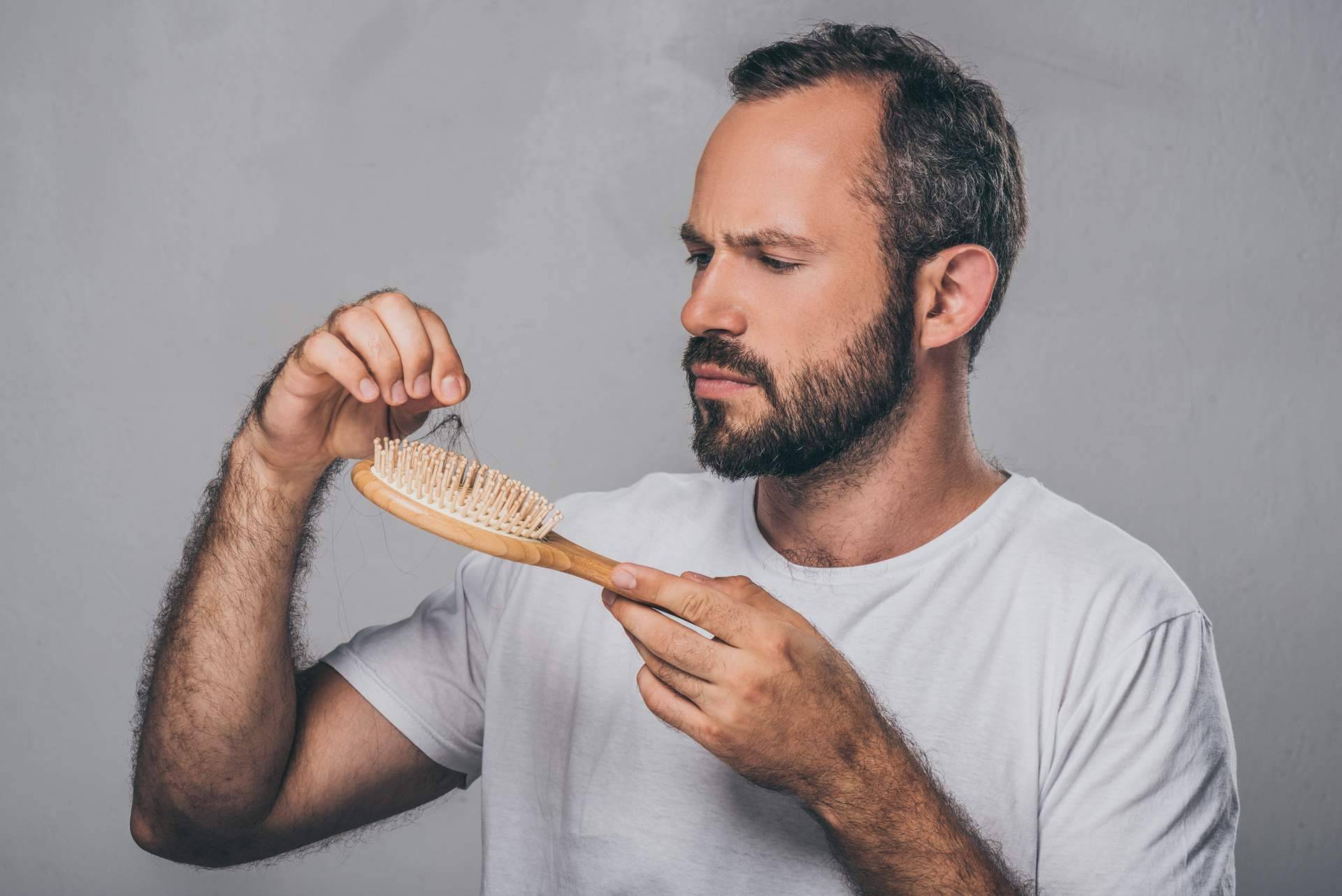 Saw Palmetto y los tratamientos para la alopecia androgénica