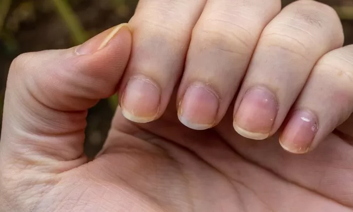 Previene las uñas amarillas con estos cuidados