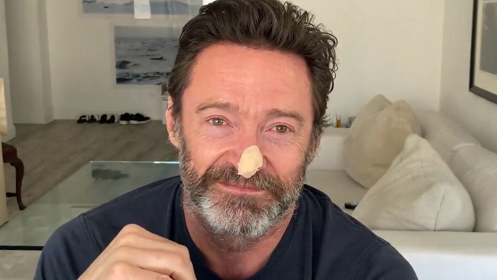 La enfermedad que cambio la vida personal y actoral de Hugh Jackman