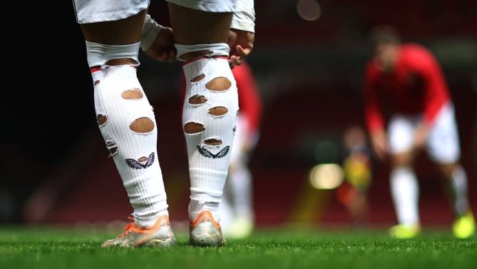 La verdadera razón por la que los futbolistas agujerean sus calcetines