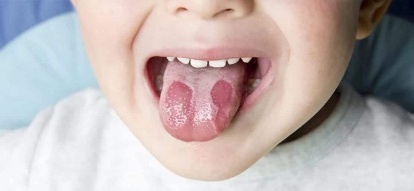 lengua
