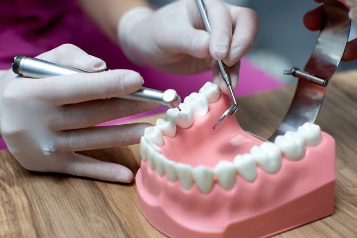 implantes dentales