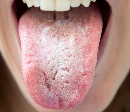 lengua