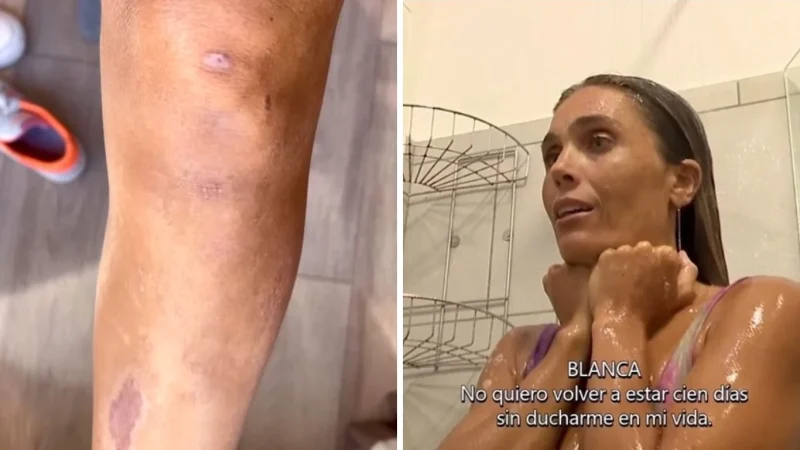 Secuelas psicológicas de Blanca Manchón tras su paso por ‘Supervivientes 2024’ 1 Merca2.es La vida de Banca Manchón después de "Supervivientes 2024"