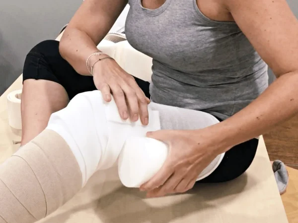 Linfedema: 5 señales de alerta que no debes ignorar