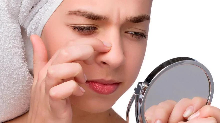 Esta es la mascarilla que promete arrancar los puntos negros de raíz