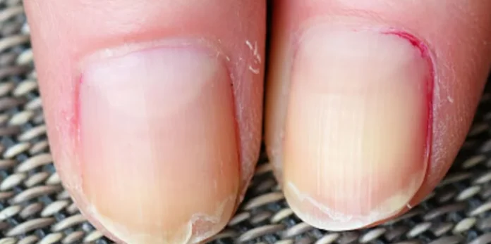 Tus uñas te están avisando: acude al médico urgentemente si las tienes así