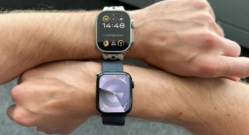 Transforma por completo tu Apple Watch con esta funda de TinyPod