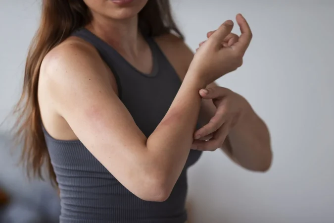 woman suffering from rash Merca2.es