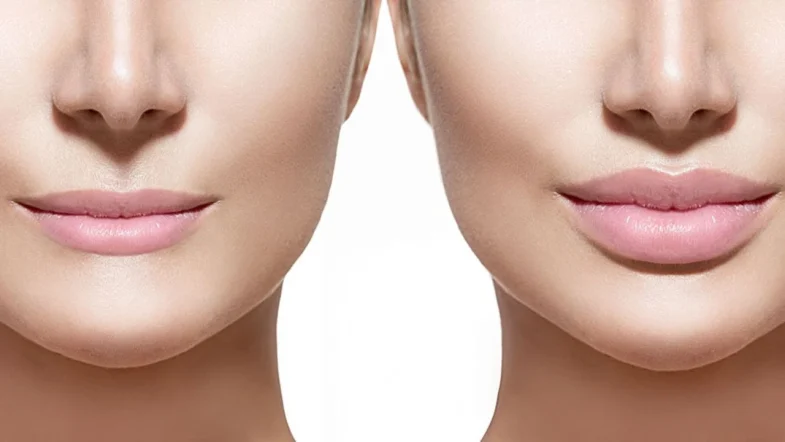Labios carnosos como los de las estrellas: el secreto que todas quieren conocer