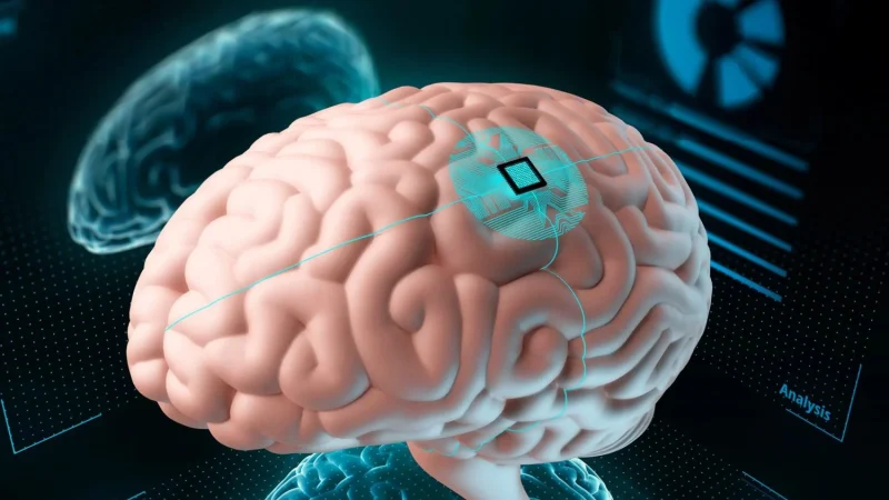 Paciente Neuralink