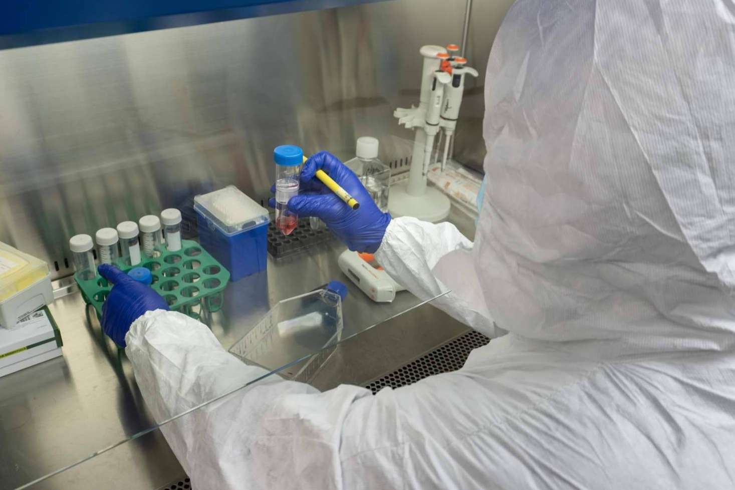 Oncocit, pionero en innovación y biotecnología de precisión para el cáncer