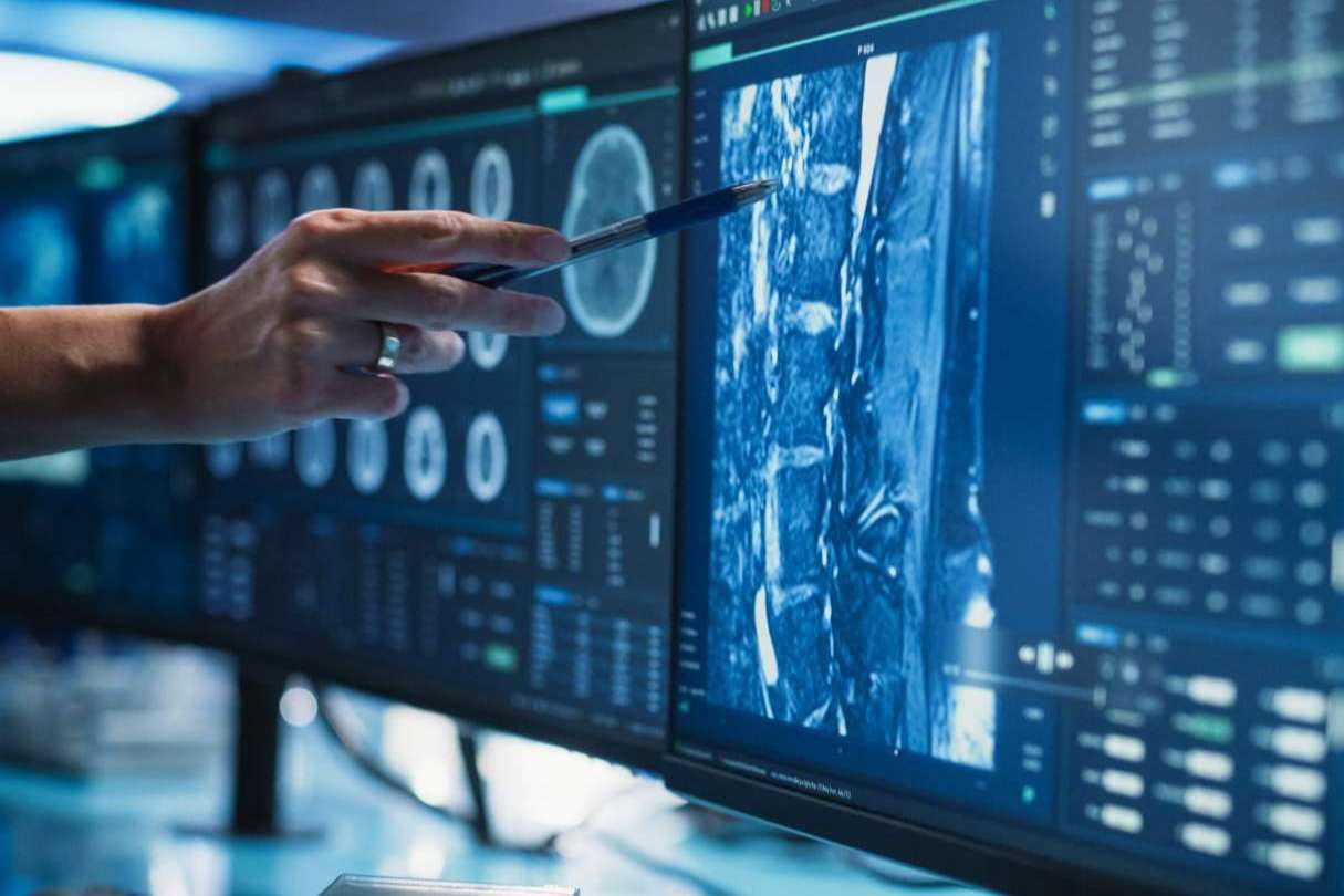 Nuevos avances en tratamientos personalizados contra el cáncer con Oncocit