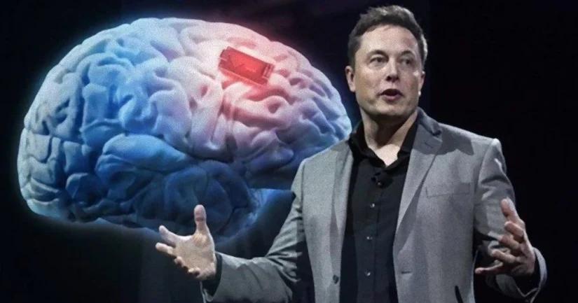 Es increíble: Elon Musk explica la nueva función de los chips cerebrales de Neuralink 1 Merca2.es Musk función