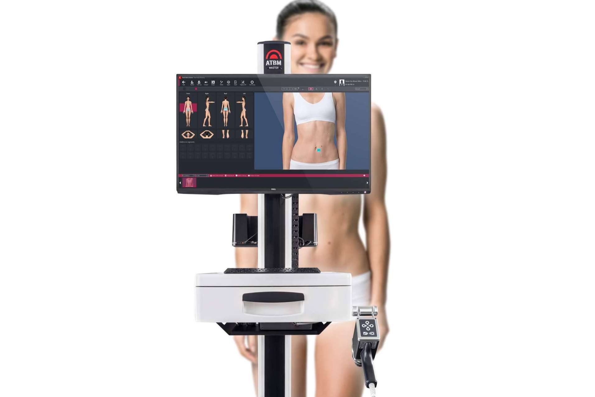 FotoFinder optimiza el diagnóstico para la prevención y detección temprana del cáncer de piel