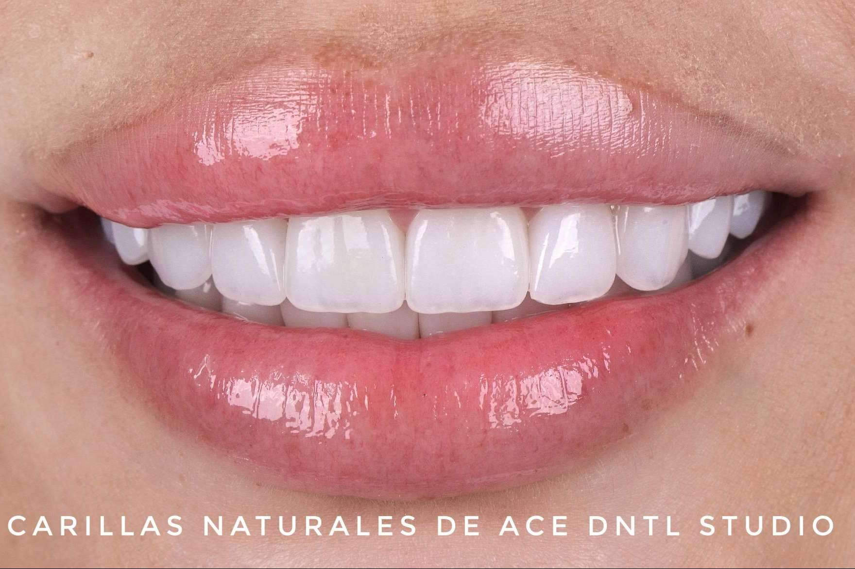 ACE DNTL STUDIO; Redefiniendo la Odontología en Marbella