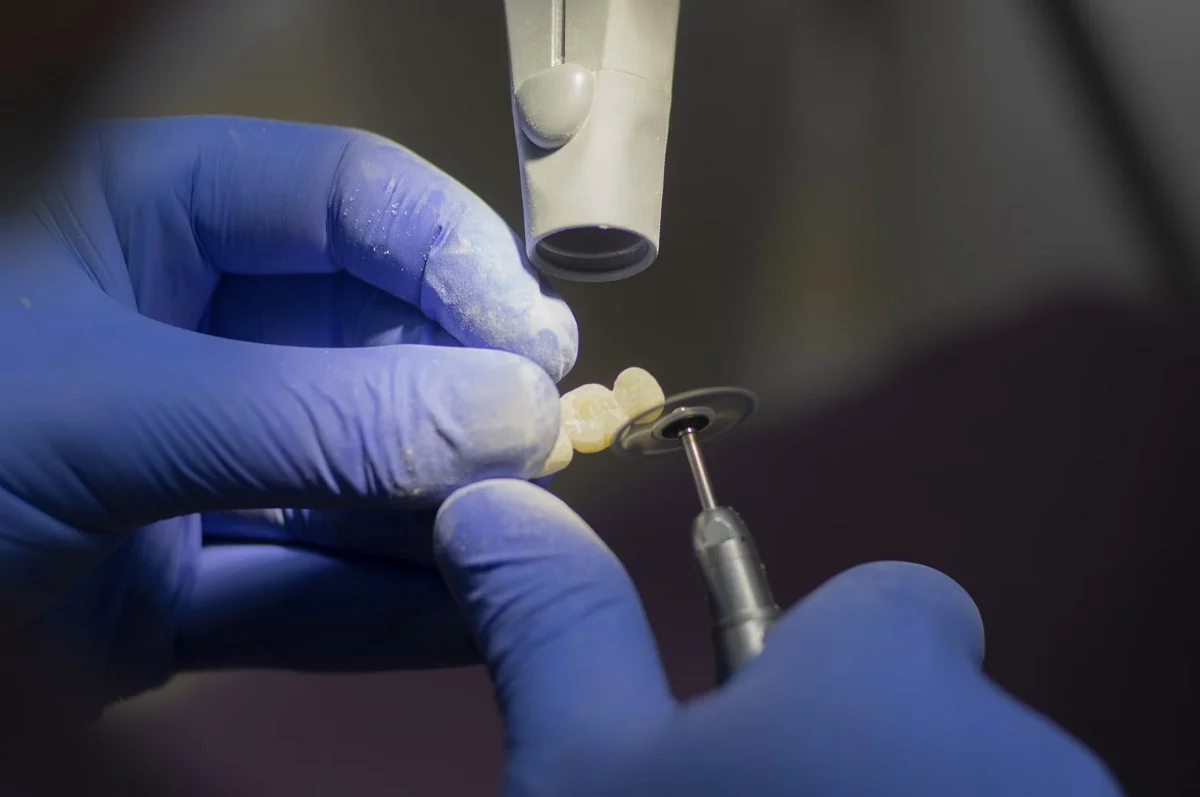 Dentalios: cuidando tu sonrisa, mejorando tu calidad de vida