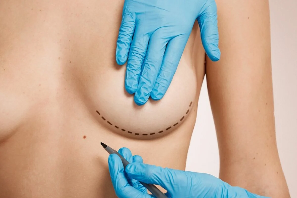 La evolución de la cirugía estética en España: cada vez más mujeres y hombres optan por intervenciones menos invasivas