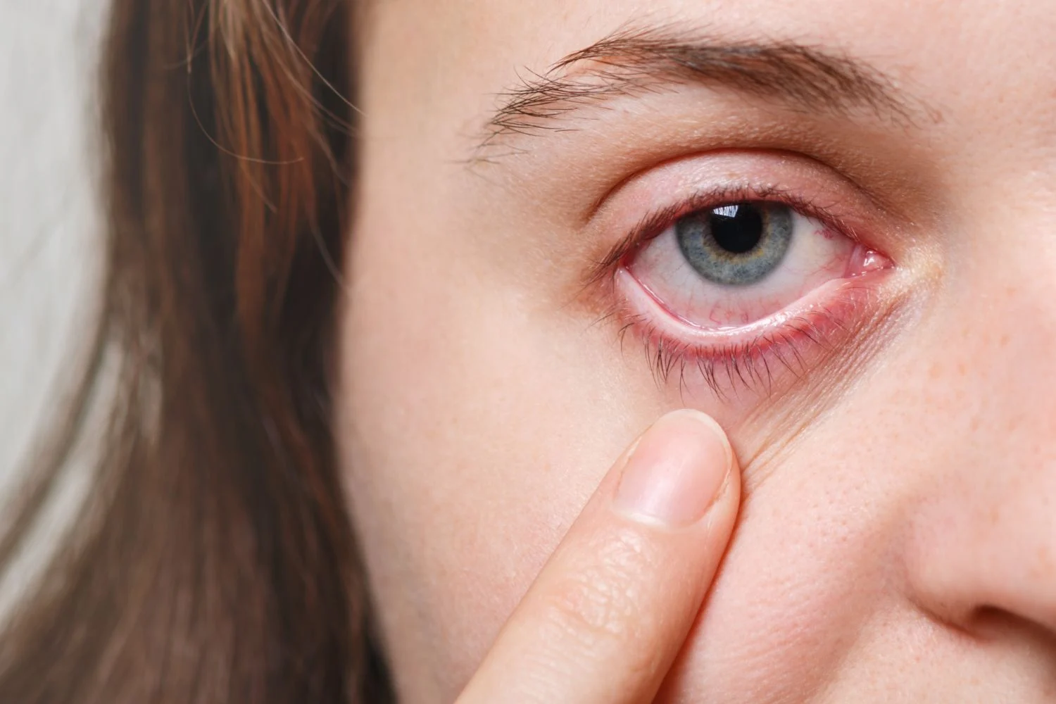 Si ves esto en tus ojos, puede que tu colesterol esté disparado