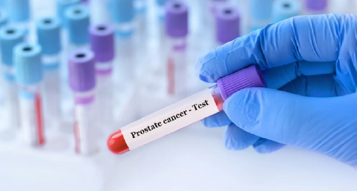Cáncer de próstata