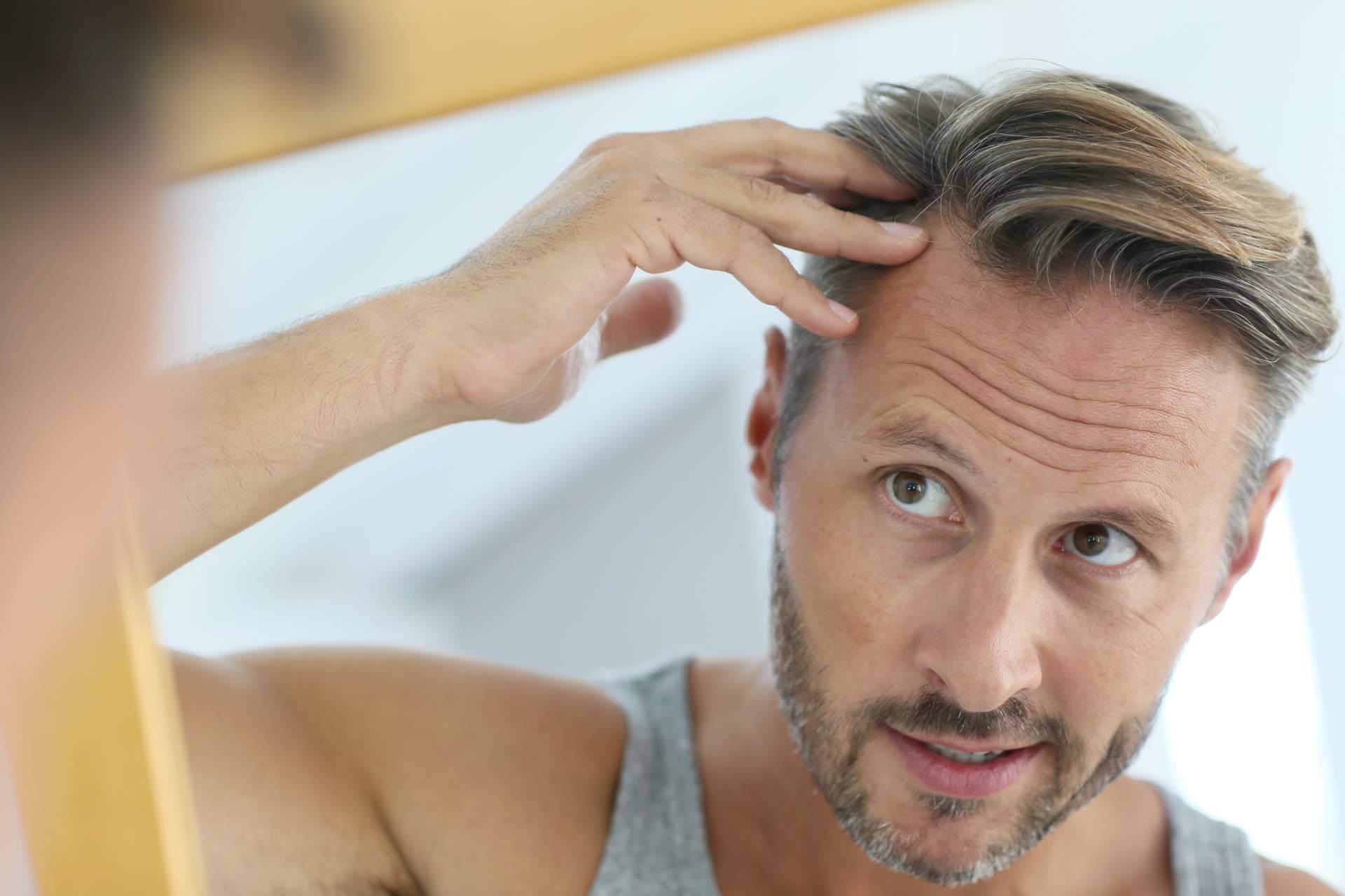 HairFluencer impulsa Xpecia, el suplemento líder para la alopecia con bloqueadores de DHT
