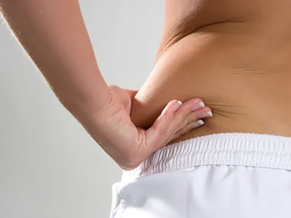 Una esperanza realista y emocionante, sin liposucción de por medio