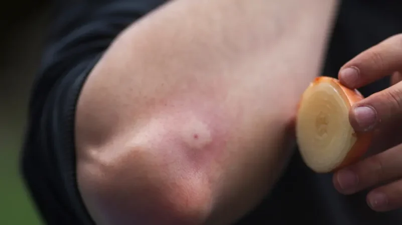 No se trata de una cura milagrosa, pero…