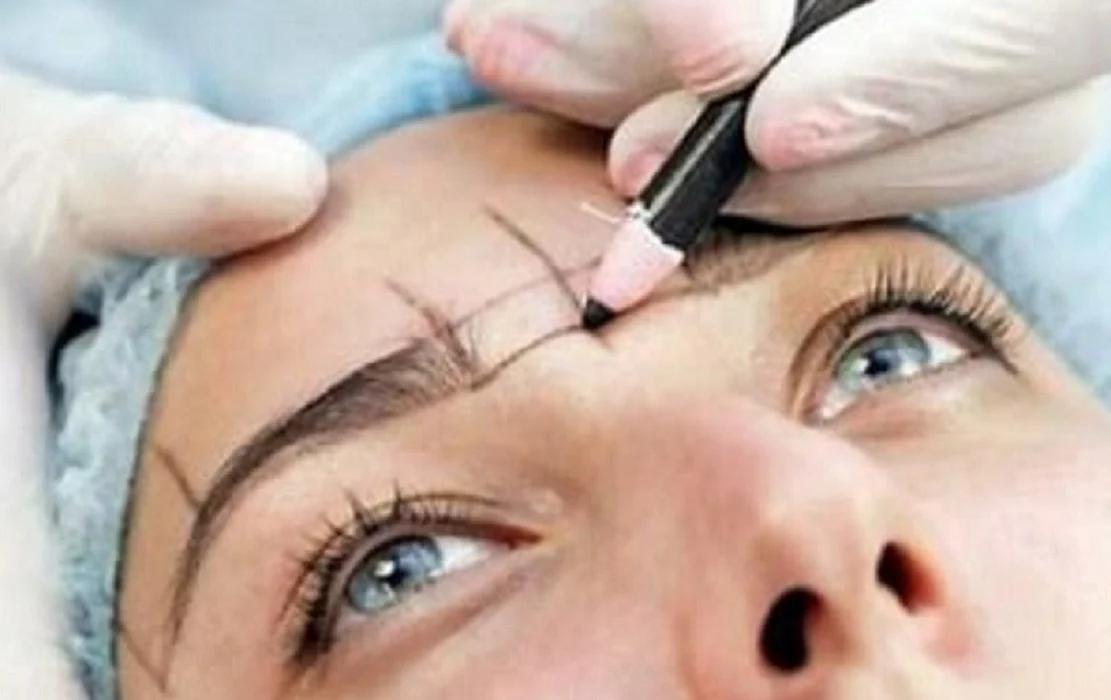 Injerto de cejas