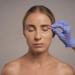 Blefaroplastia: la cirugía que devuelve juventud… y visión
