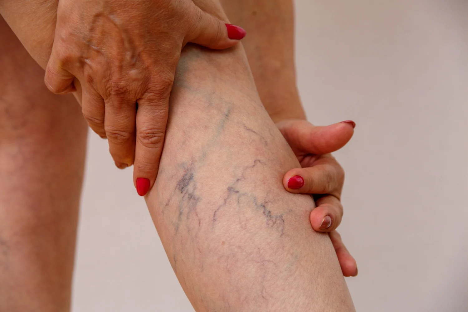 Dra. Laura Benítez, dermatóloga: 